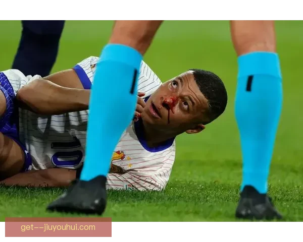 姆巴佩欧洲杯对阵奥地利受伤鼻梁骨折引发关注